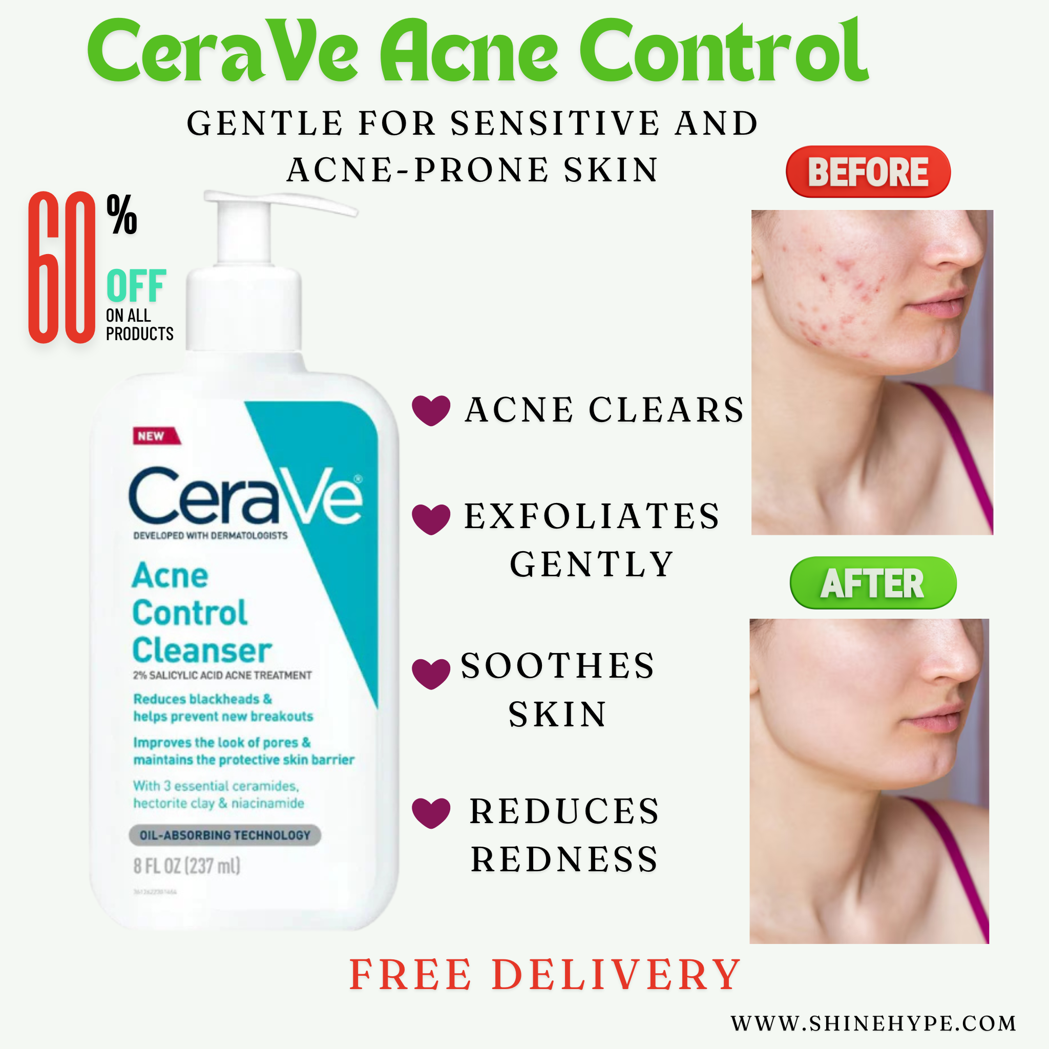 CeraVe Acne Control Cleanser 237ML