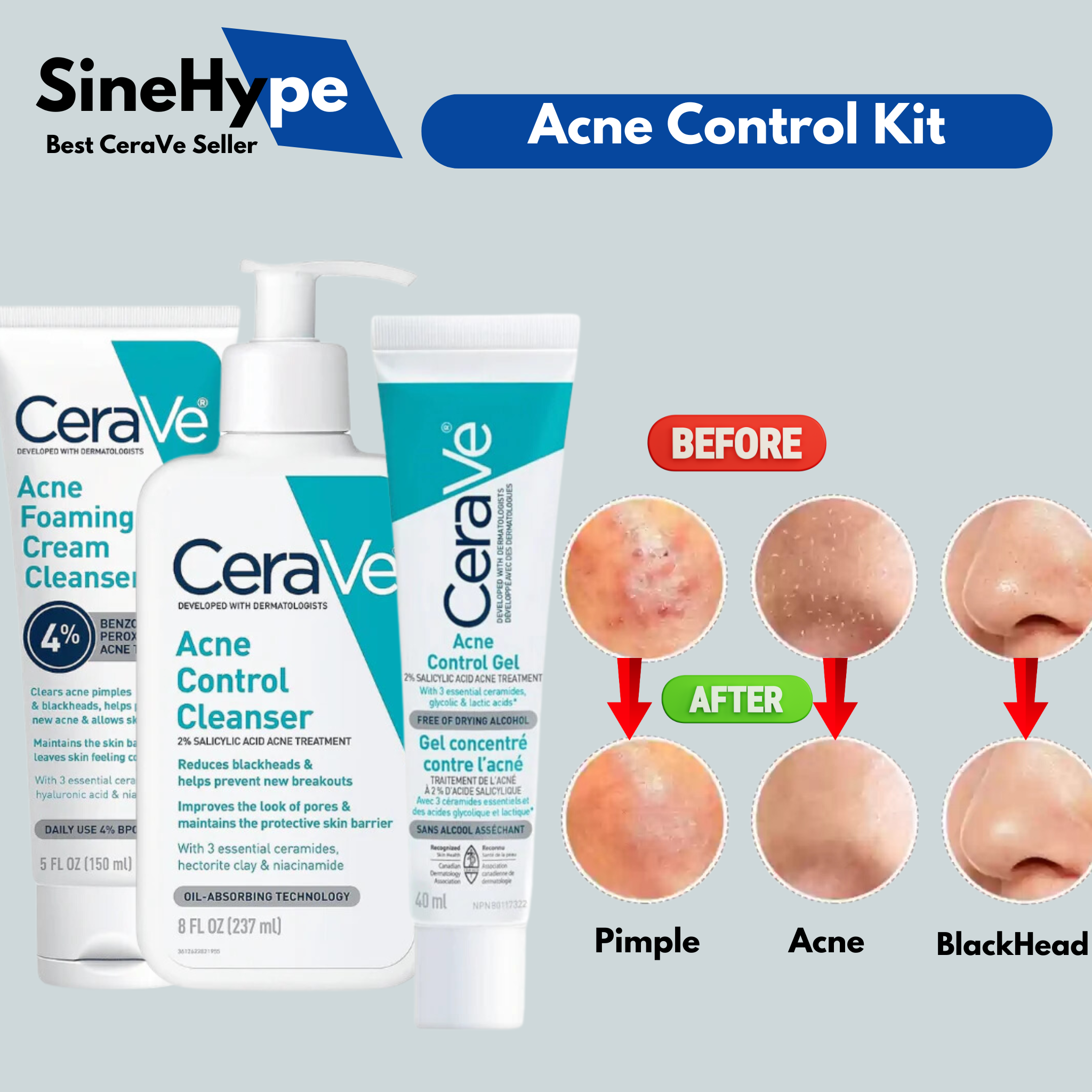 CeraVe Acne Control Kit