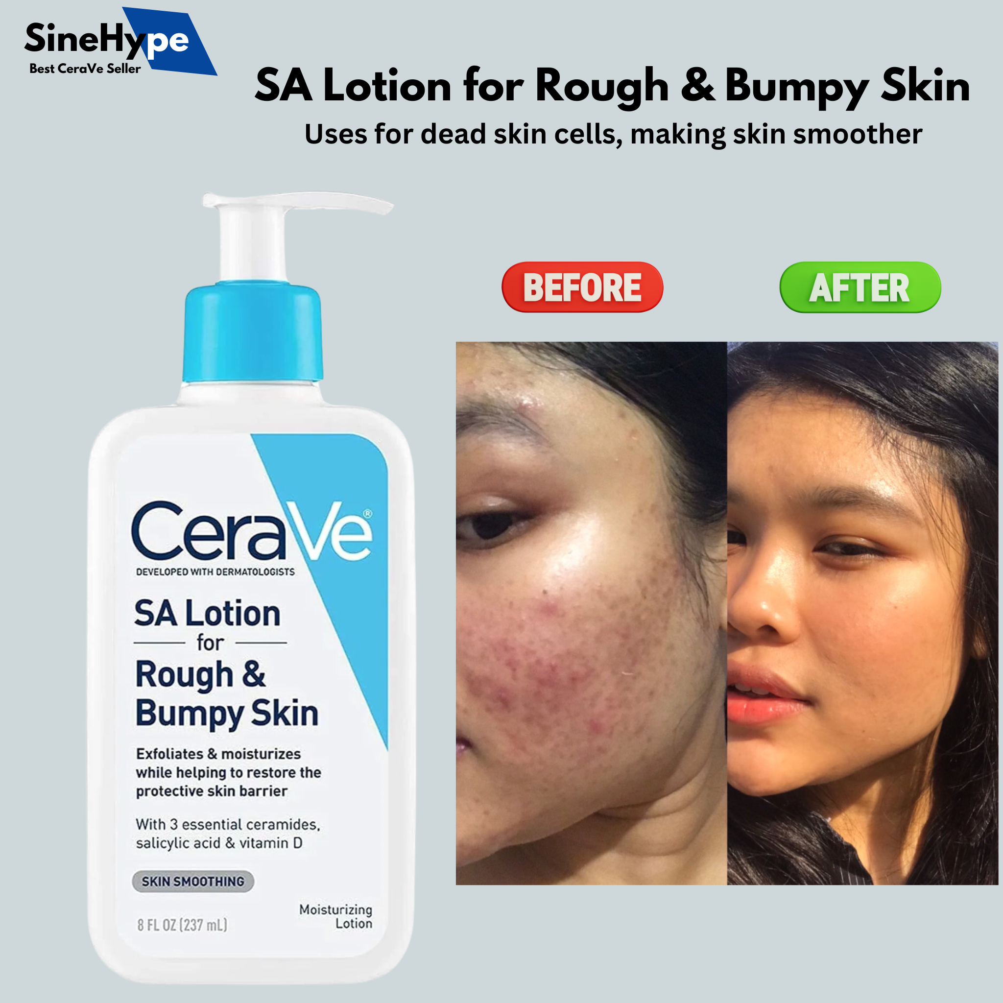 CeraVe  SA Lotion for Rough & Bumpy Skin